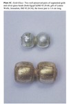 Plate IC - Gold-Glass Beads: A Review of the Evidence